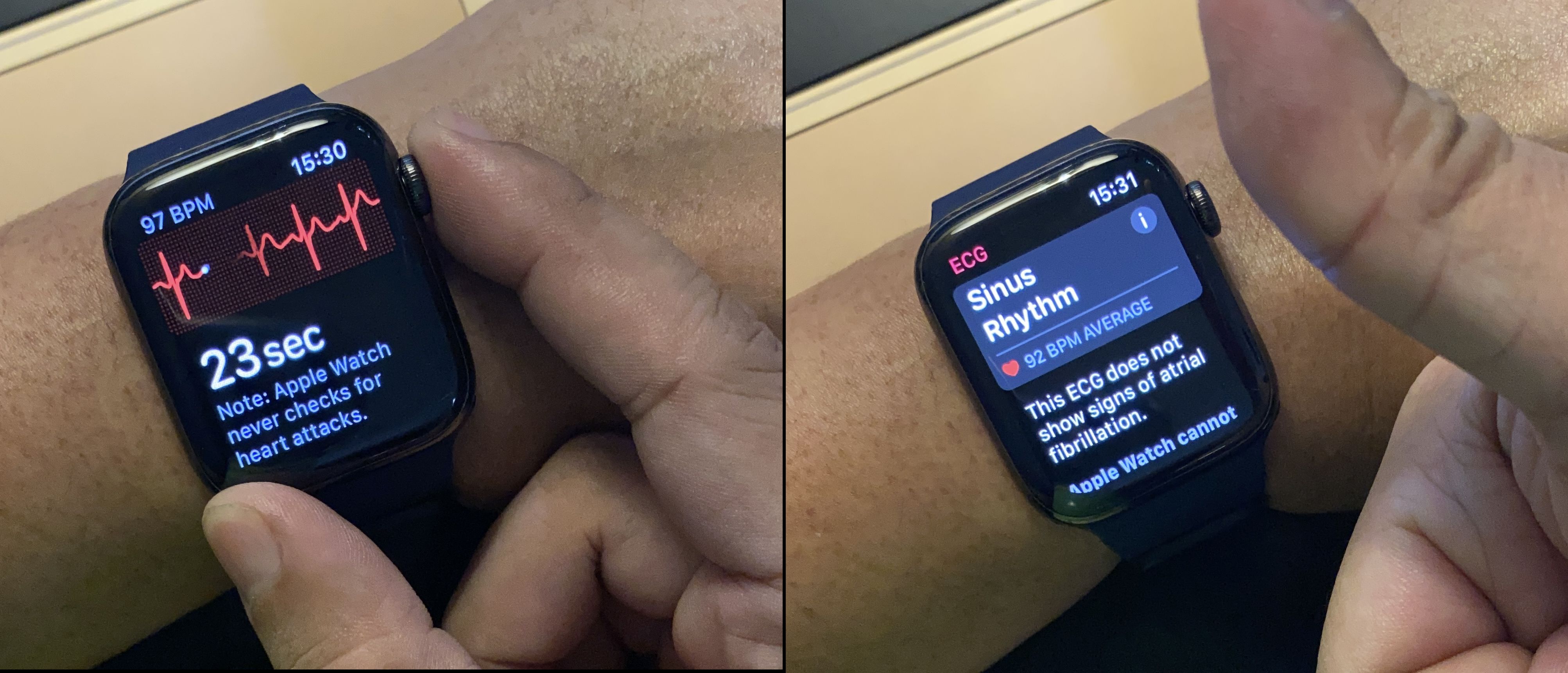 REVIEW: Apple Watch Series 6 (KT26147924.PNG)