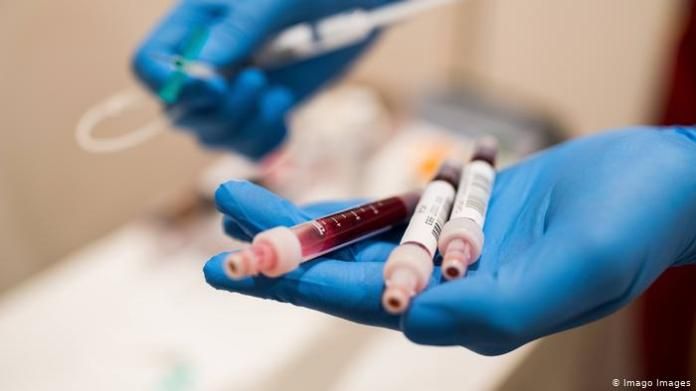 Symbol picture blood test antibody test test coronavirus (Imago Images)