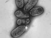Plague pathogen Yersinia pestis: The infectious disease was first detected in the Mediterranean region in the 6th century. The bacterium was discovered in 1894. Nowadays, if diagnosed early, the chances of a cure with antibiotics are high. Plague pathogen Yersinia pestis: The infectious disease was first detected in the Mediterranean region in the 6th century. The bacterium was discovered in 1894. Nowadays, if diagnosed early, the chances of a cure with antibiotics are high.