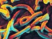 Ebola virus: The virus causes fever with internal bleeding. The disease is fatal in up to 90 percent of cases. Scientists are working flat out on a vaccine. Ebola virus: The virus causes fever with internal bleeding. The disease is fatal in up to 90 percent of cases. Scientists are working flat out on a vaccine.