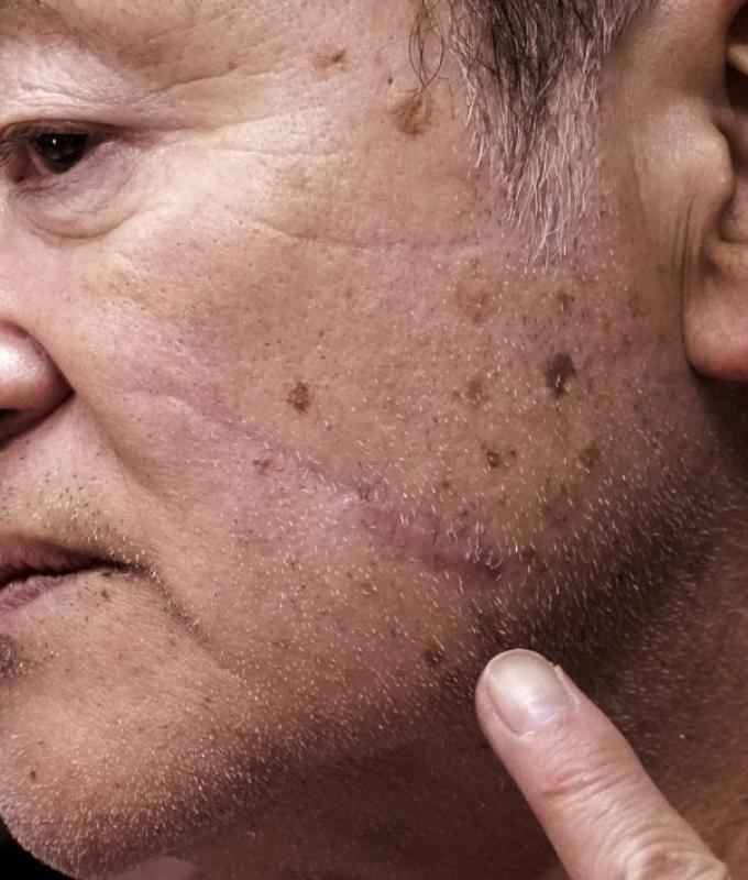 Bears roam towns ‘almost every day’ as Japan faces deadly surge