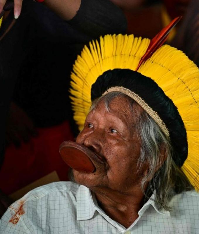 Indigenous icon Raoni undergoes surgery, fervent defender of Amazon rainforest