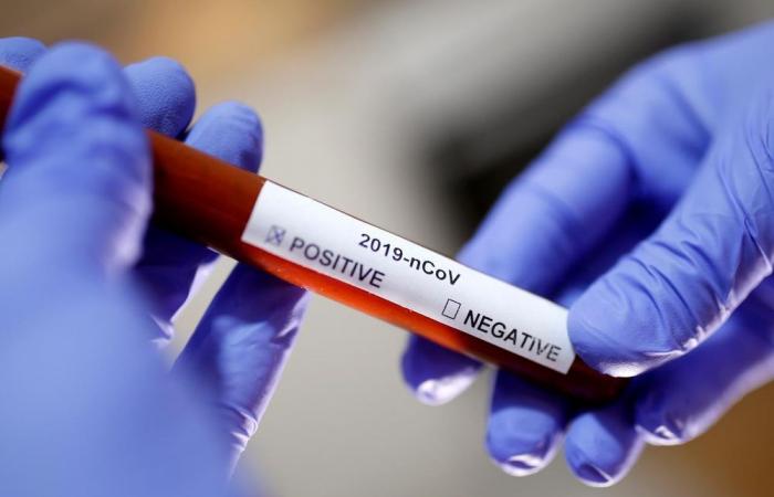 Israel isolates coronavirus antibody in ‘significant breakthrough’, says minister