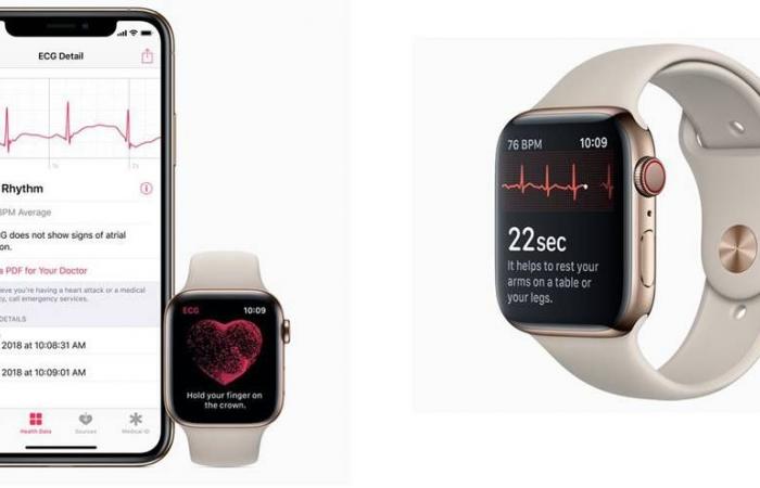 ECG app & irregular heart rhythm notification coming to Apple Watch