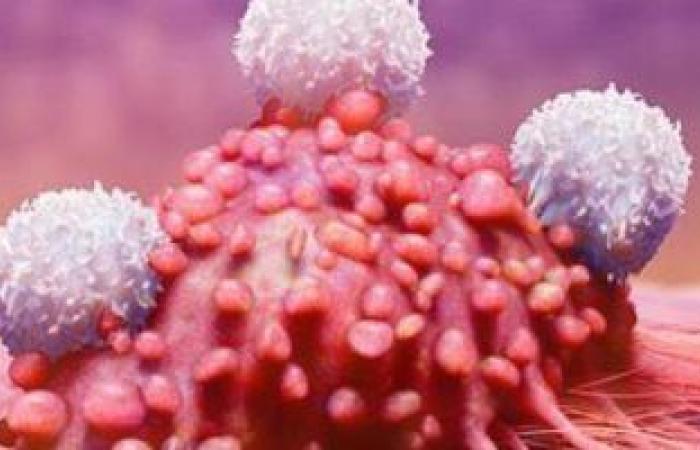 Learn the causes of leukemia