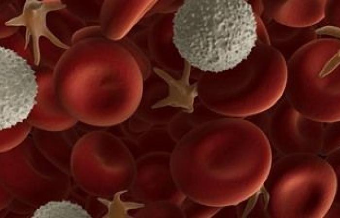 Learn the causes of leukemia