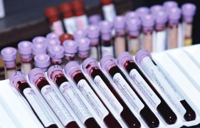 Your blood type can predict your risk for severe COVID-19