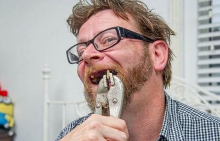 man extracts his own teeth and uses beer “anesthetic”