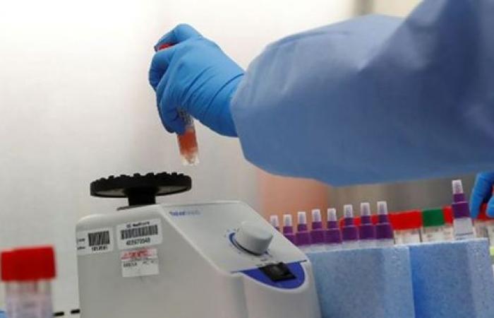 New blood test predicts which Covid-19 patients are at high risk