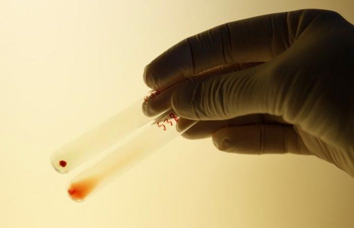 Two studies reveal the blood type of people at the lowest...
