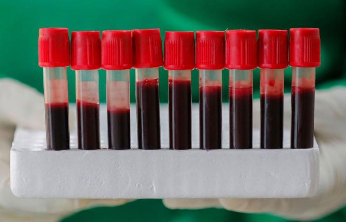 Two studies reveal the blood group less likely to be infected...