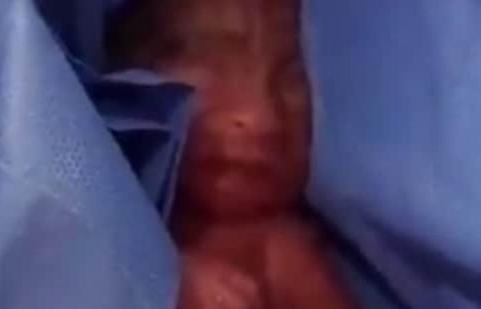 ‘Dead’ premature baby found alive in the morgue