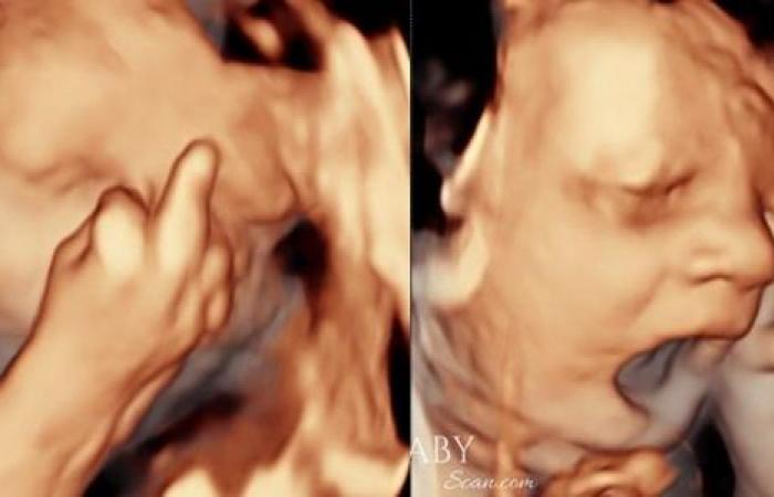 Baby shocks parents by showing ‘middle finger’ and yawning on ultrasound