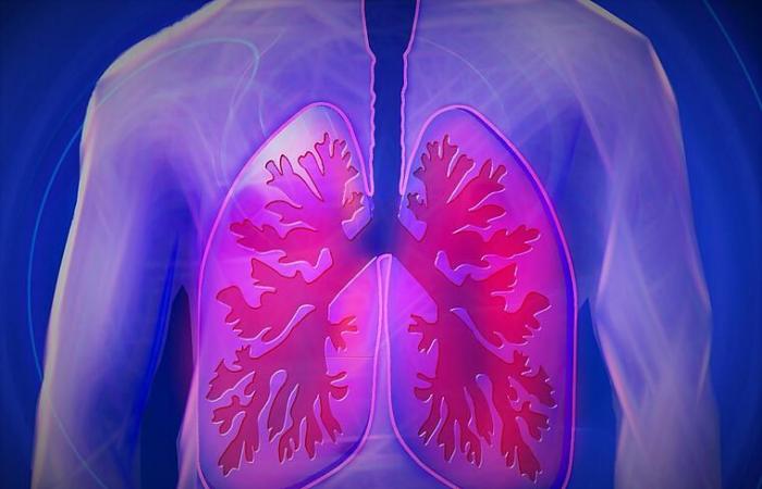 Corona: How Covid-19 destroys the lungs