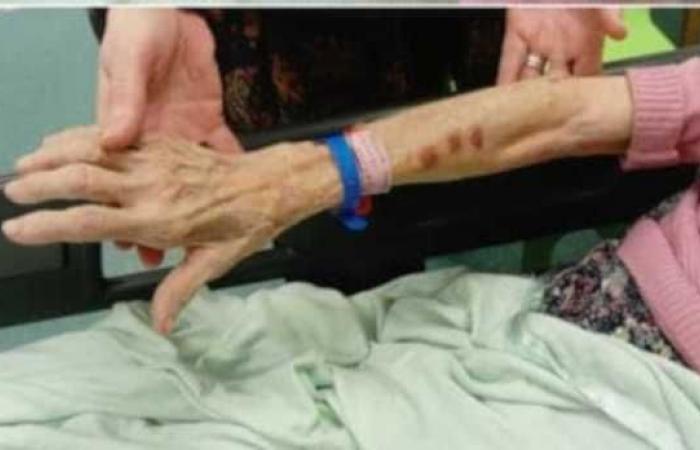 The family shares harrowing images of Gran, 90, after she was...