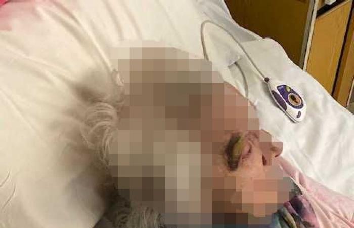 The family shares harrowing images of Gran, 90, after she was...
