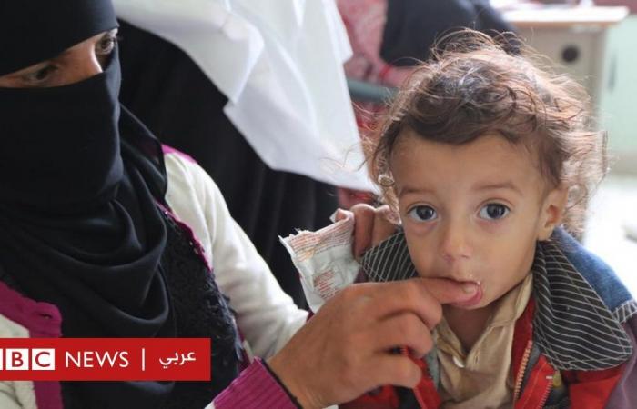 Children of Yemen are “dying of starvation,” and the “scandal” of...