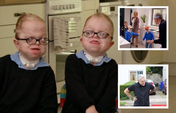 The house of the twin family with a rare genetic disease...