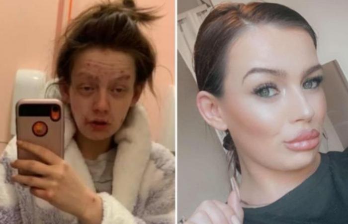 Heroin addict Demi-Nicole Dunlop shares incredible before and after photos