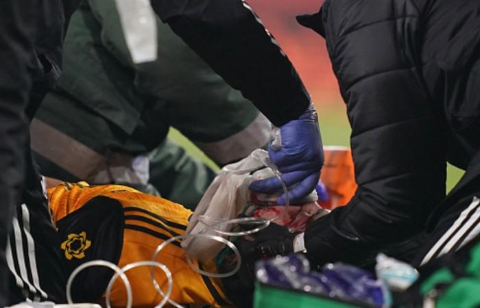 Arsenal vs. Wolves: Shocking injury to Raul Jimenez, lost consciousness. ...