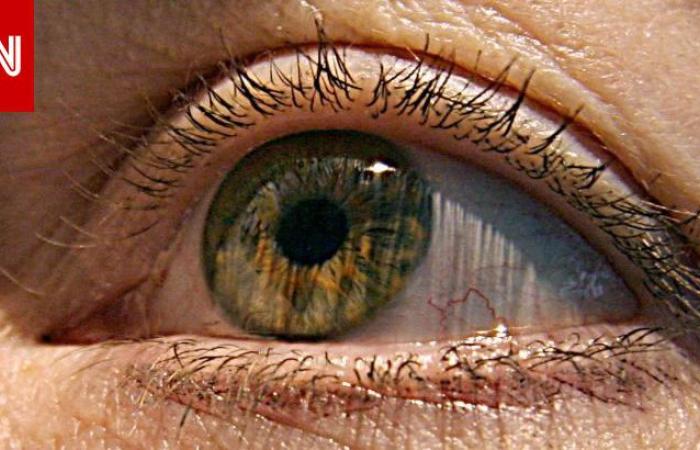 The main cause of blindness in Saudi Arabia.. What is cataract...