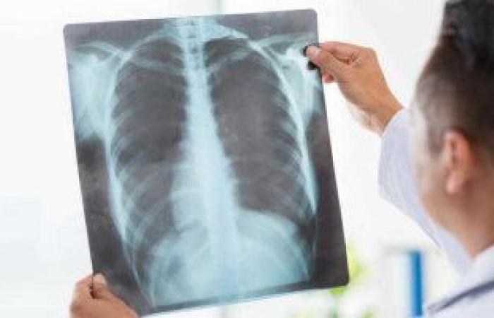 Signs that tell you that your lungs still need treatment after...