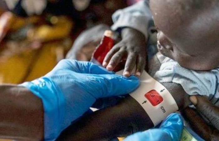Sudan: Children dying amid healthcare system collapse