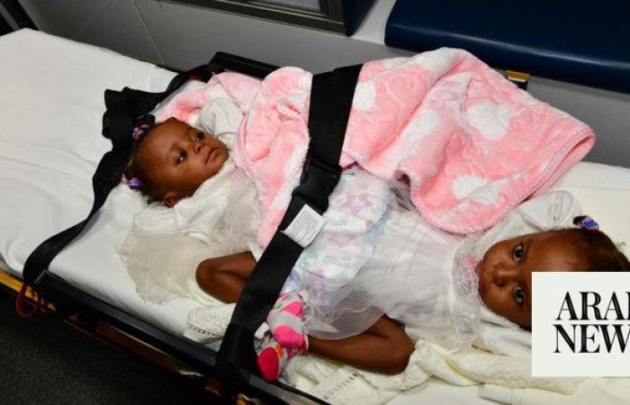 Nigerian conjoined twins arrive in Saudi Arabia for separation assessment
