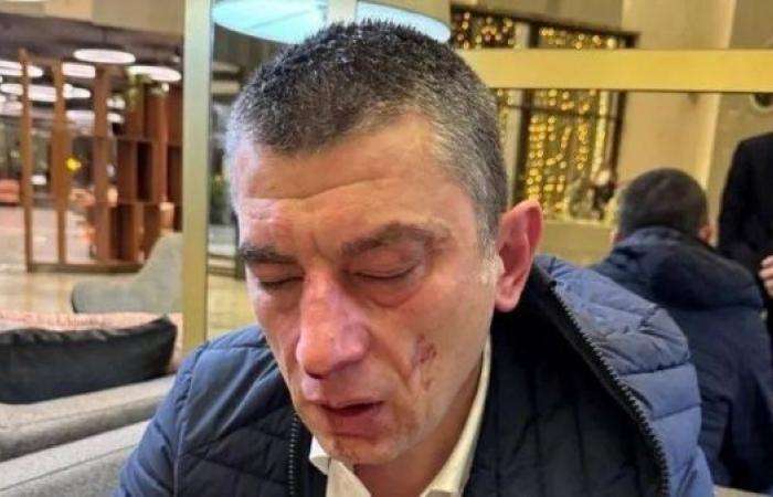 Georgian opposition leader beaten up, blames governing party members