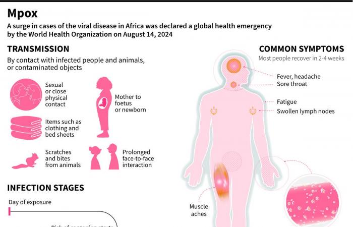 Why child-killer diseases like dengue, cholera and mpox have surged worldwide