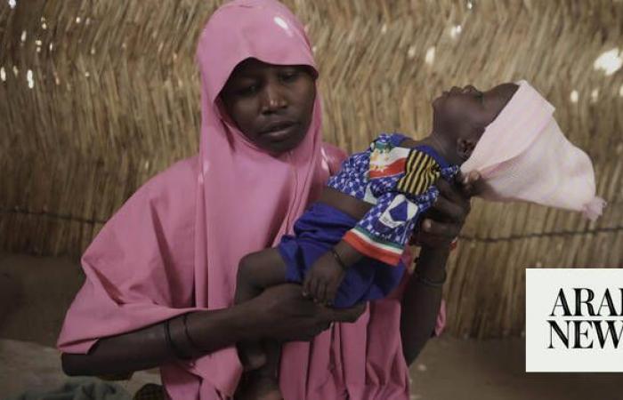 Children die as USAID aid cuts snap a lifeline for the world’s most malnourished