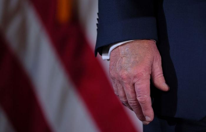 No clot, just clout: Trump’s bruises from ‘frequent handshaking’, says White House