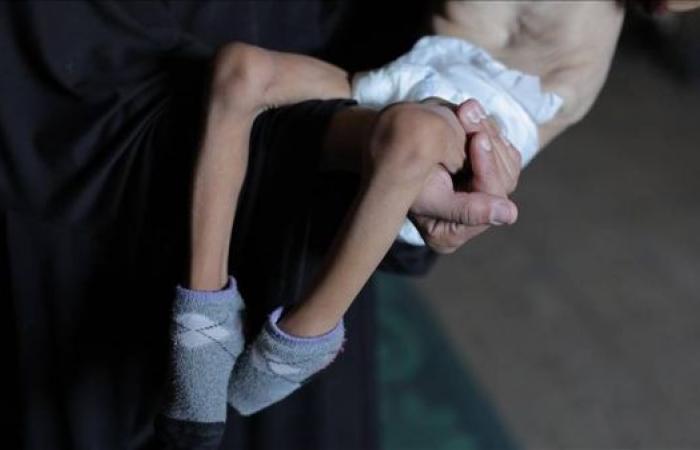 Five more Palestinians, including two children, die of starvation in Gaza