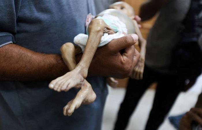 Hunger is killing Gaza’s children, and it’s man-made, says WHO