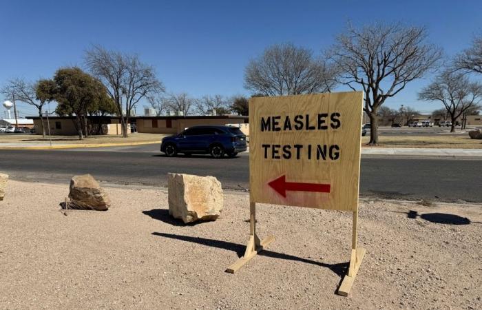 Premature baby dies of measles in Alberta, first confirmed fatality in Canada’s outbreak