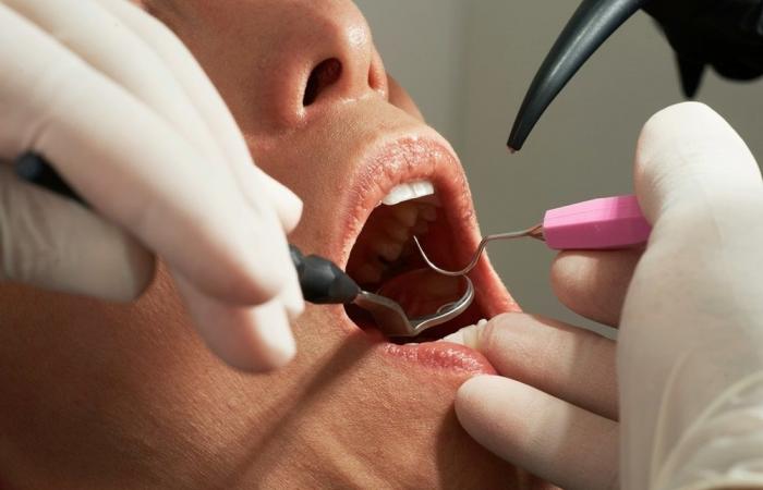 Countries agree to phase out mercury tooth fillings by 2034 under Minamata Convention