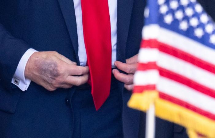 Trump says bruises from aspirin, not age — insists he’s just ‘blinking, not dozing’