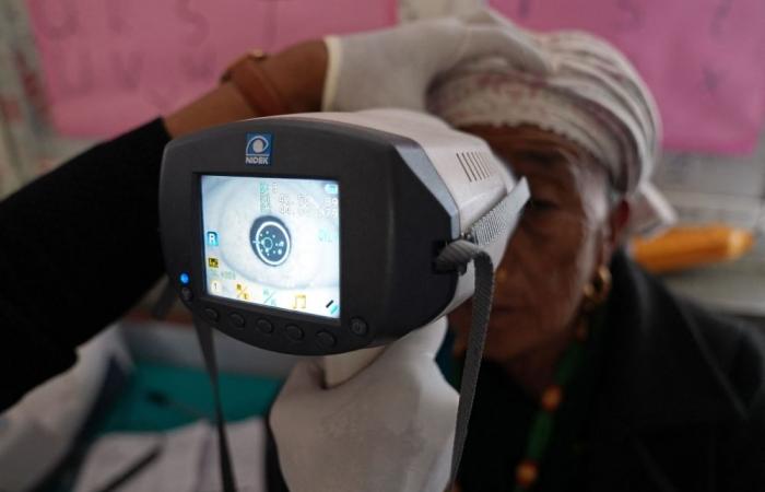 WHO: 94 million need cataract surgery, but access lacking