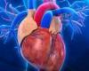 Cardiovascular diseases cause 17.9 million deaths in the world annually