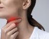 Sore throat is a symptom of infection with the Coronavirus