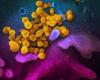 Coronavirus survives on the skin five times longer than the flu,...
