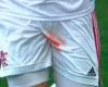 Pain just by watching: a Brazilian player bled a testicle in...