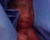 ‘Dead’ premature baby found alive in the morgue