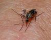 Microneedle plaster for quick, blood-free malaria tests