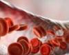 A study identifies a new cause of blood clots in Corona...
