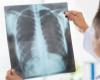 Signs that tell you that your lungs still need treatment after...