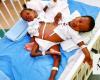 Saudi experts to separate conjoined Tanzanian twins