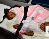 Nigerian conjoined twins arrive in Saudi Arabia for separation assessment