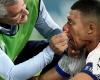Mbappé’s facial injury places doubt on his continued involvement in Euro 2024