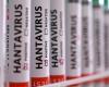 Countries track passengers from virus‑hit cruise ship as Hondius heads to Spain